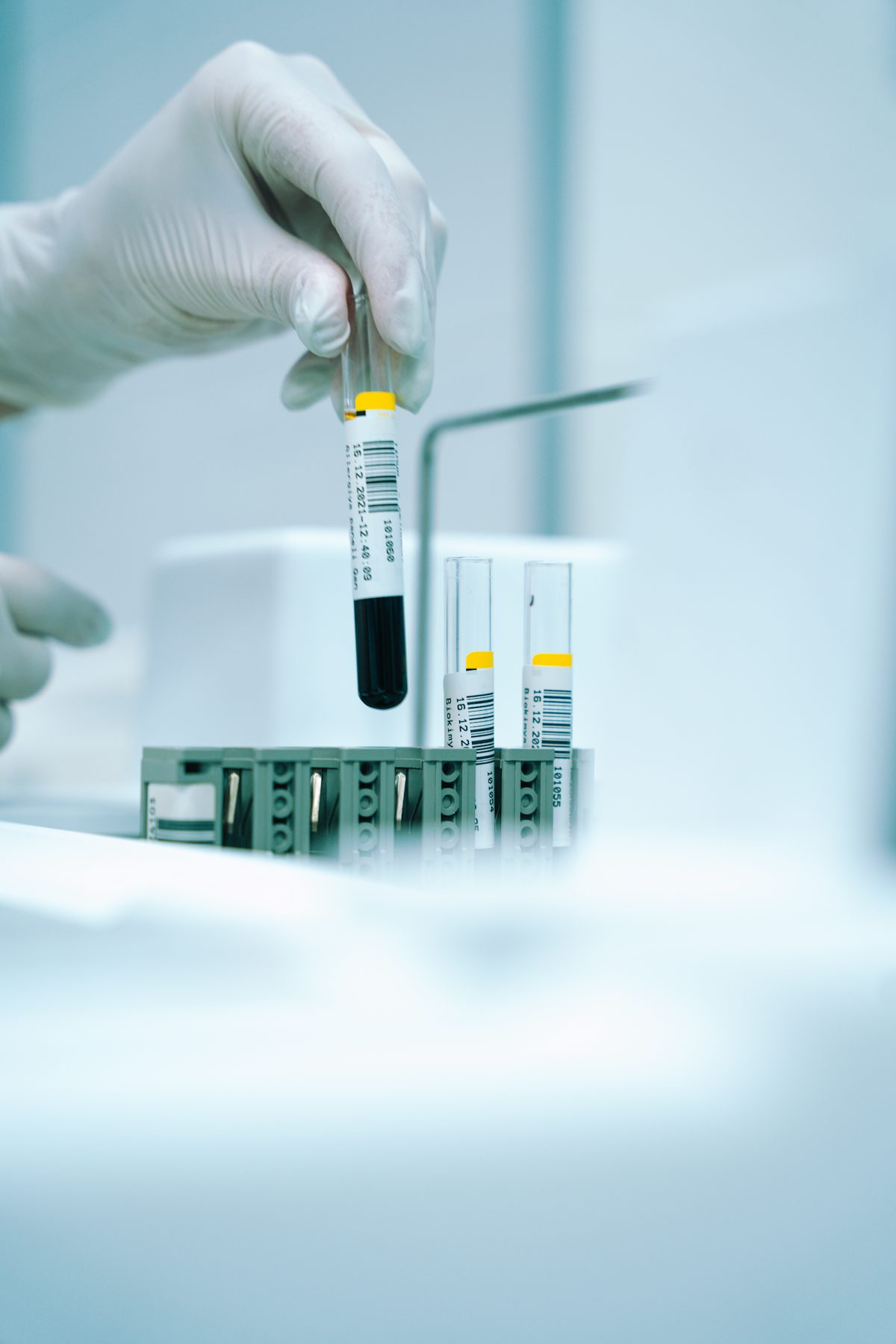 Diagnostic test tube analysis